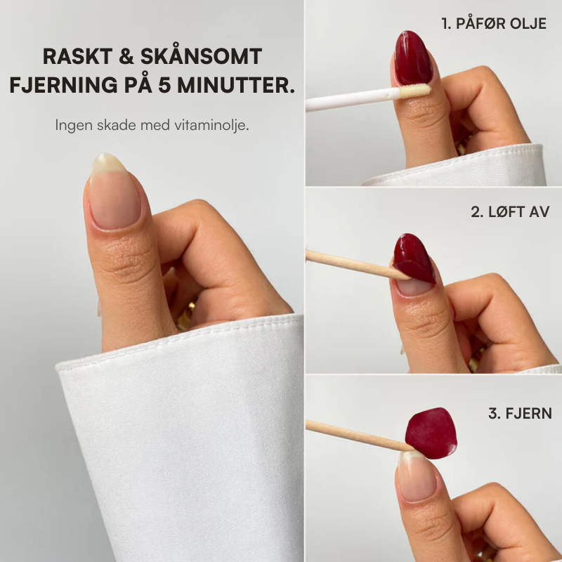 Neglekit Startsett