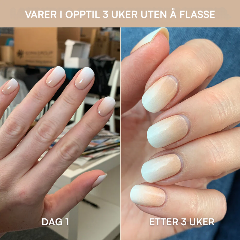 Neglekit Startsett