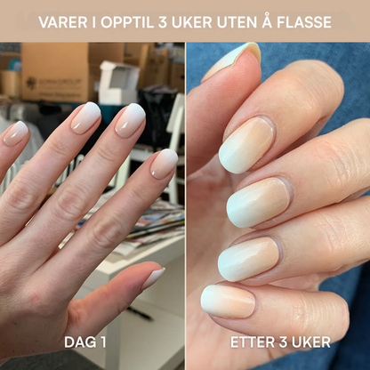 Neglekit Startsett